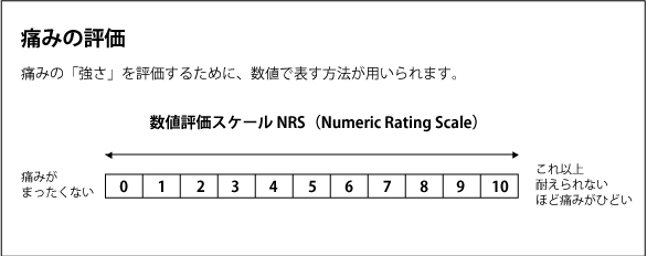 痛みの評価　数値評価スケールNRS（Numeric Rating Scale）